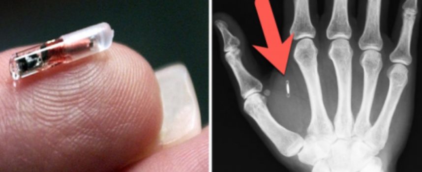 Greyerz – Implantable Human Microchips And The Great Reset